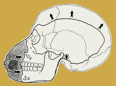 Skull